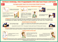 Таблица "Порядок действий при опасном кровотечении" (100х140 сантиметров, винил) - fgospostavki.ru - Муравленко