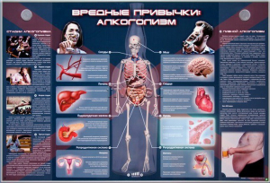 Электрифицированный стенд "Вредные привычки: алкоголизм" - fgospostavki.ru - Муравленко